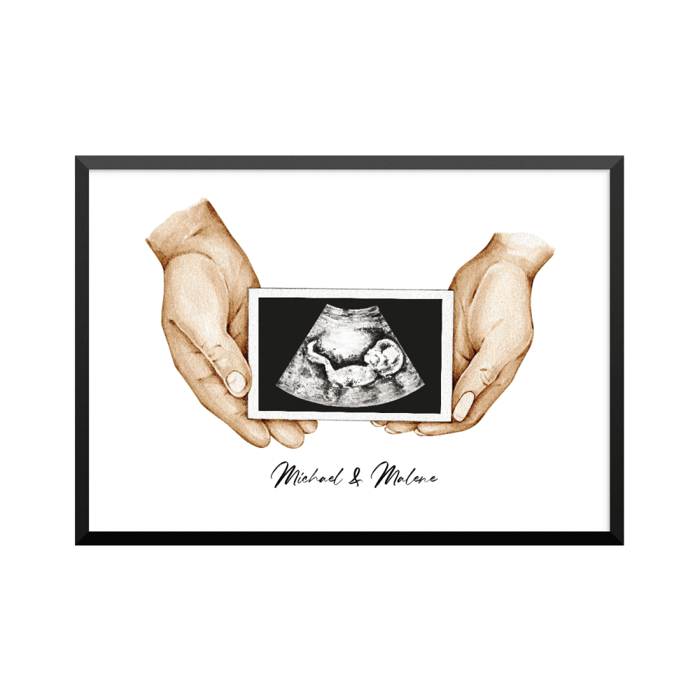 Plakat: Scanningsbillede par, gravid, familie